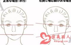 下颌骨不对称矫正手术多少钱