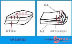 欧洲之星4d抗衰多久做一次 做一次要多少钱