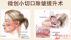 除皱的更好方法有什么？各项方式大比拼